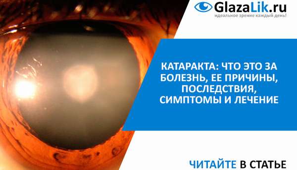 симптомы и лечение катаракты
